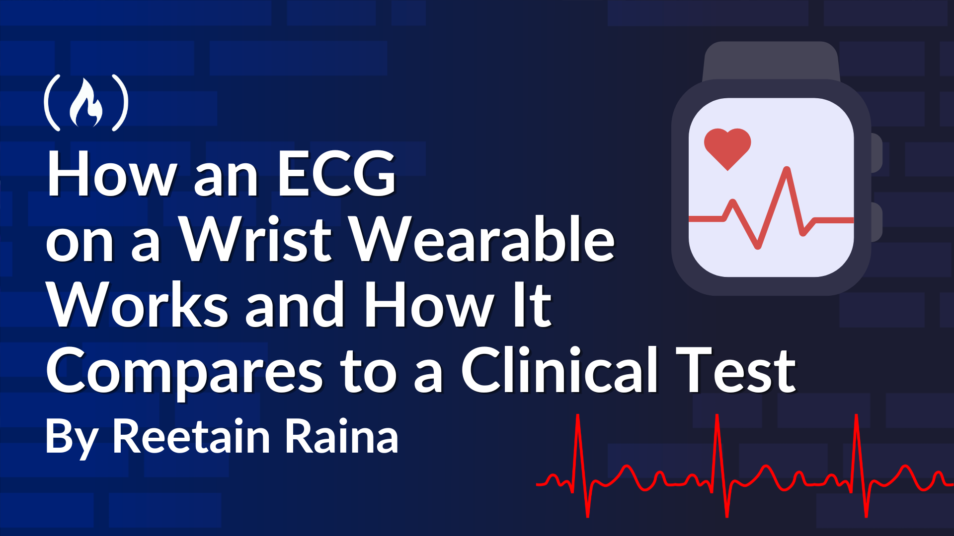 How an ECG on a